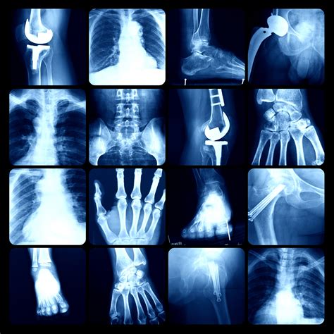 Radiological.